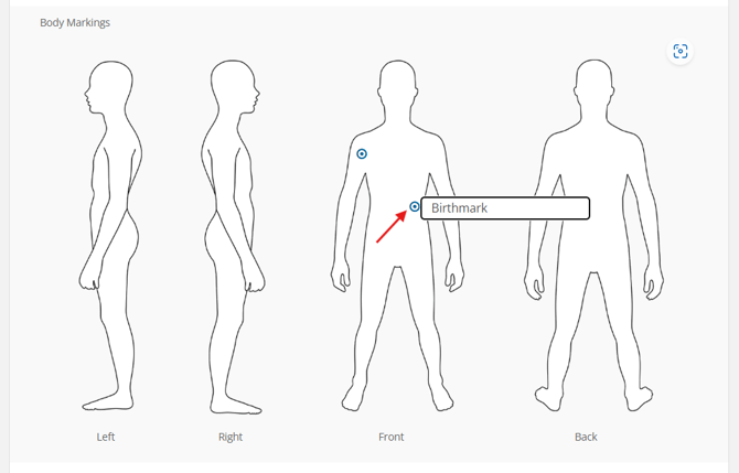 Embalming > Body Markings chart
