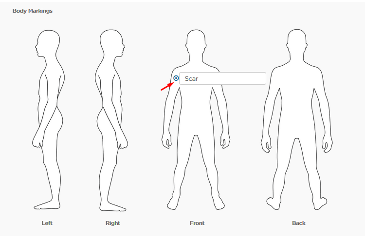 Body Markings section